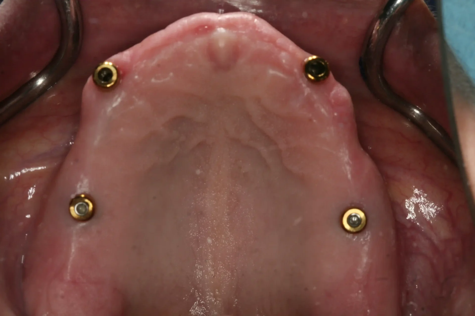 teeth