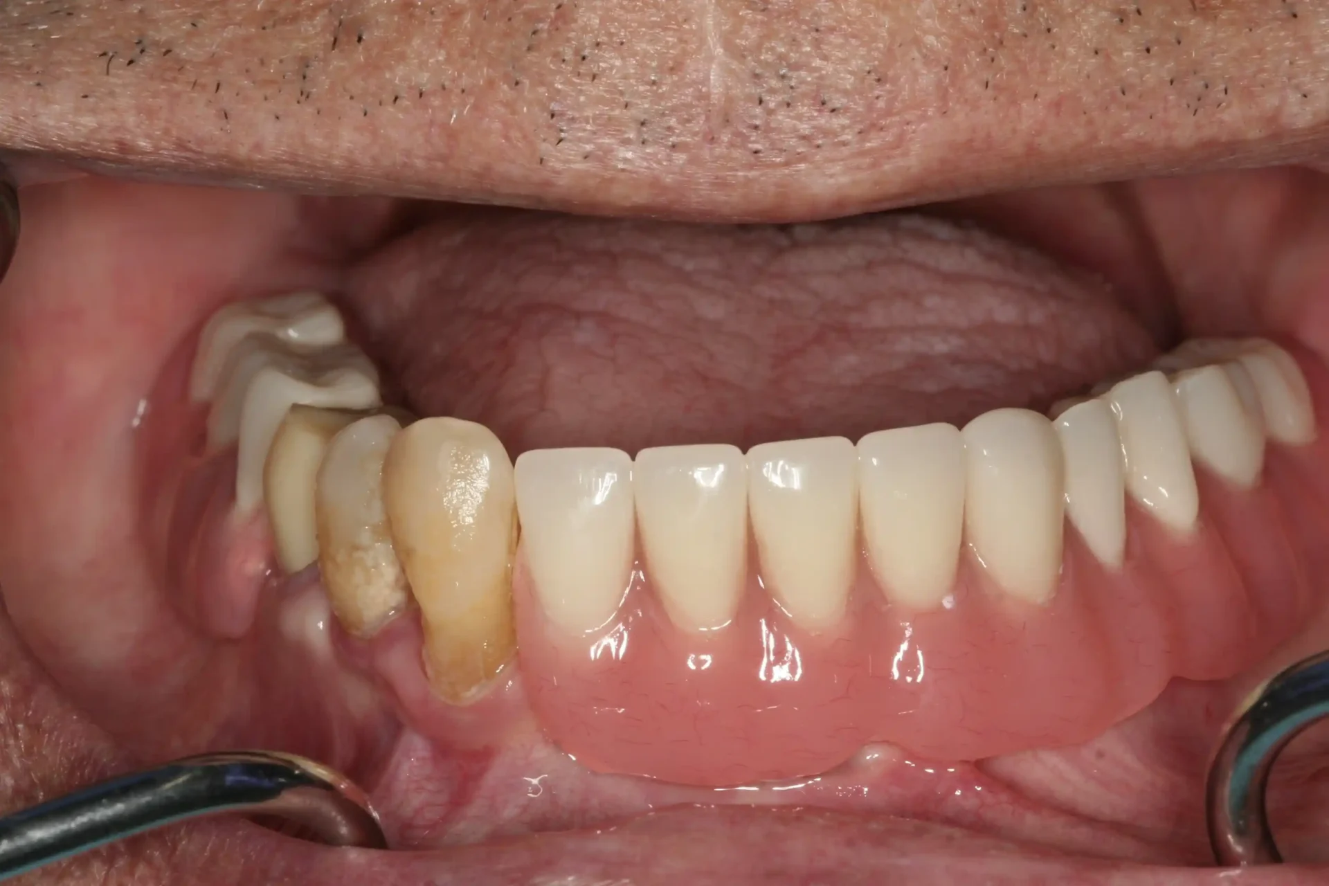 teeth