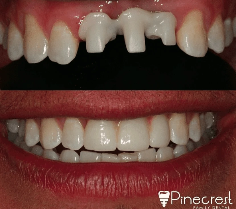 teeth