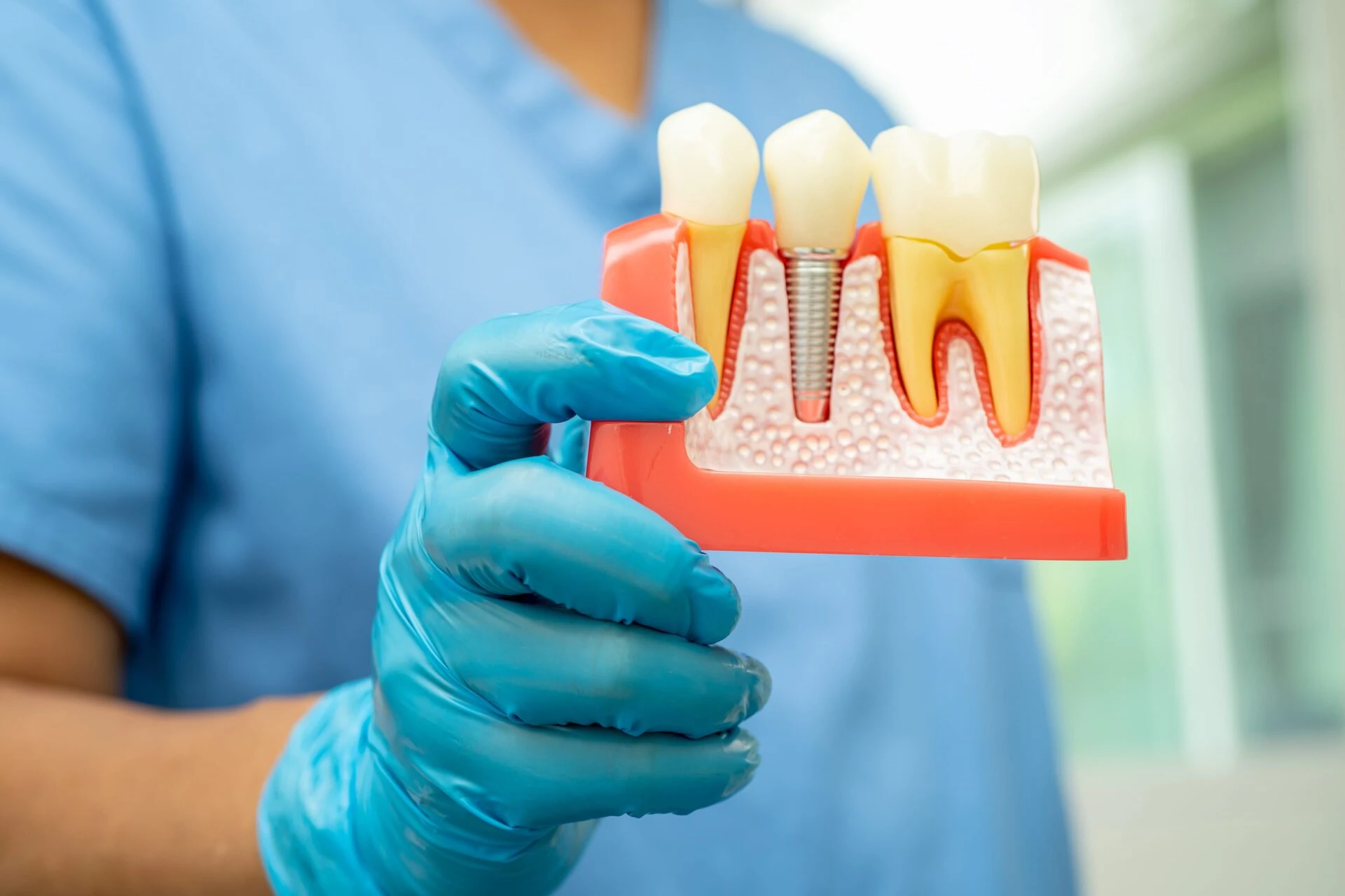 Teeth case at Pine Crest Family Dental